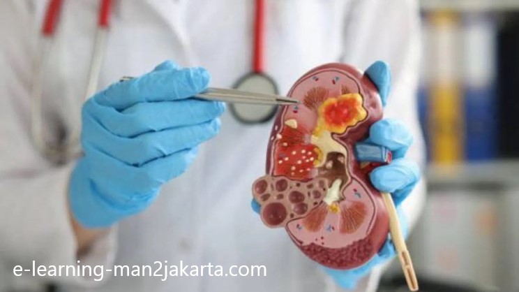 Kesehatan Organ Tubuh Manusia